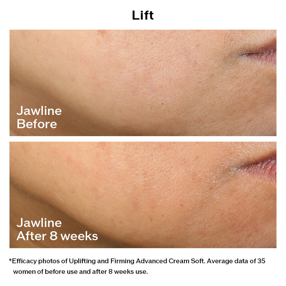 Uplifting and Firming Advanced Cream Soft (Refill) - VITAL